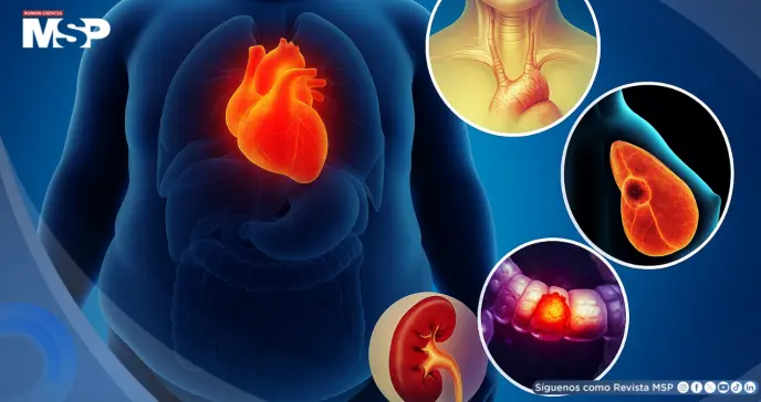 Alertan sobre el aumento de cánceres relacionados con la obesidad en jóvenes y adultos: Estudio Alertan sobre el aumento de cánceres relacionados con la obesidad en jóvenes y adultos: Estudio