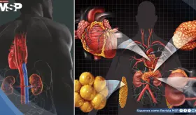 Qué es el síndrome cardiovascular renal-metabólico, que podría afectar a 9 de cada 10 adultos