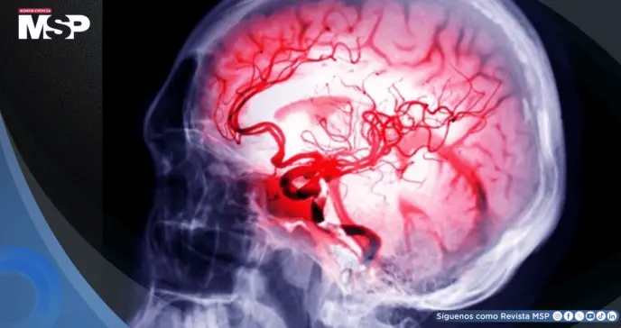 ¿Qué es un aneurisma cerebral? El más reciente diagnóstico de Kim Kardashian relacionado con el estrés ¿Qué es un aneurisma cerebral? El más reciente diagnóstico de Kim Kardashian relacionado con el estrés