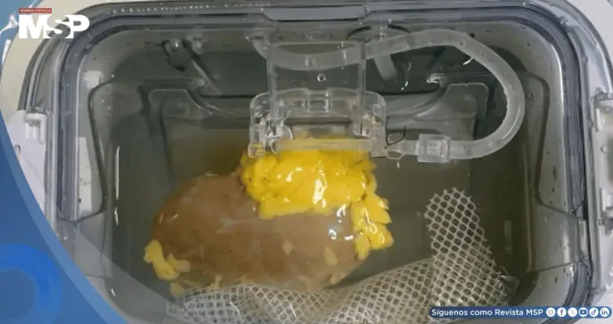 Científicos crean el primer "riñón universal" que podría ser compatible con cualquier tipo de sangre