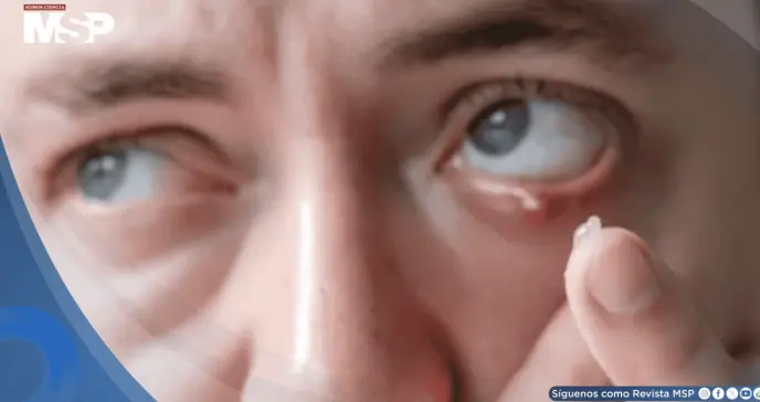 Orzuelos: por qué aparecen, cómo tratarlos y qué hacer para prevenirlos Orzuelos: por qué aparecen, cómo tratarlos y qué hacer para prevenirlos