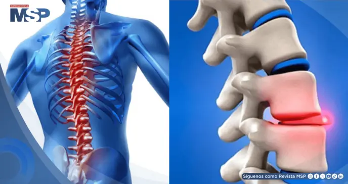 Quiropraxia: Qué es, cómo funciona y qué dice la ciencia sobre su efectividad y seguridad Quiropraxia: Qué es, cómo funciona y qué dice la ciencia sobre su efectividad y seguridad