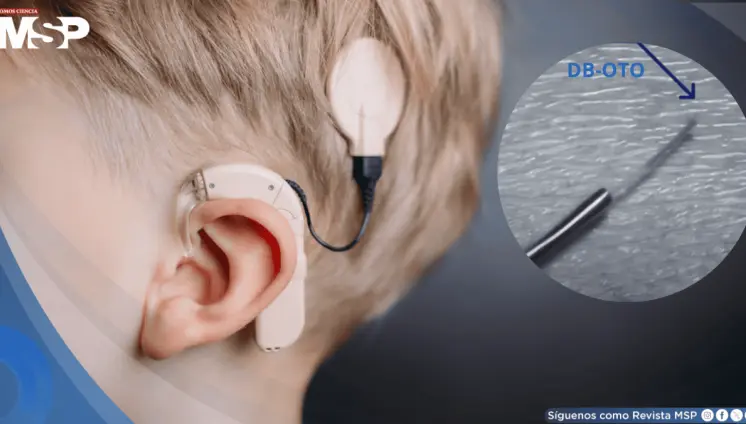 Once niños con sordera recuperan la audición gracias a terapia génica pionera