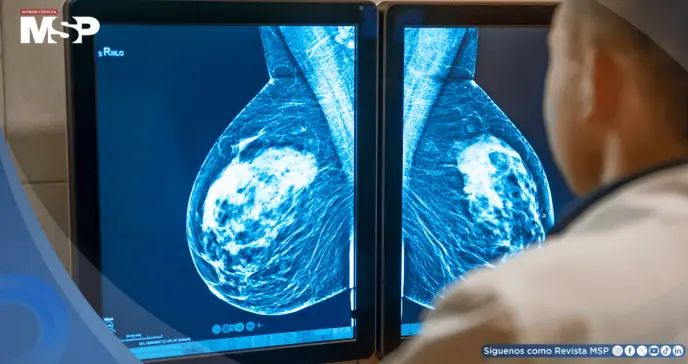 Algoritmo con inteligencia artificial detectaría el cáncer de mama antes de su aparición en la mamografía Algoritmo con inteligencia artificial detectaría el cáncer de mama antes de su aparición en la mamografía