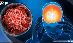 Descubren que el DMT podr&iacute;a proteger contra el da&ntilde;o cerebral tras un accidente cerebrovascular