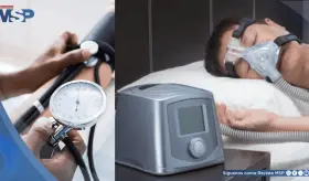 El uso del CPAP podr&iacute;a prevenir la hipertensi&oacute;n en pacientes con apnea del sue&ntilde;o, revela estudio