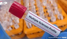 Nuevo test de sangre podr&iacute;a detectar esclerosis m&uacute;ltiple antes de los da&ntilde;os neurol&oacute;gicos