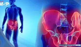 &iquest;Dolor en el pubis o la ingle? Podr&iacute;a ser pubalgia: Causas, s&iacute;ntomas y manejo 