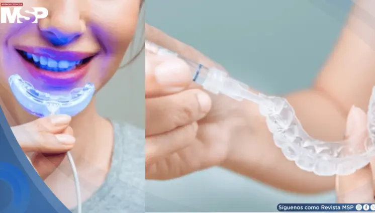 Alertan sobre kits de blanqueamiento no regulados con exceso de peróxido: dañarían el esmalte y encías Alertan sobre kits de blanqueamiento no regulados con exceso de peróxido: dañarían el esmalte y encías