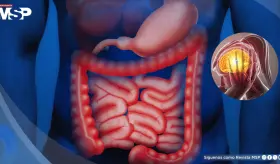 El estr&eacute;s causar&iacute;a inflamaci&oacute;n en el intestino y empeorar&iacute;a los problemas digestivos ya existentes