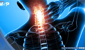 Uso del celular estar&iacute;a acelerando la degeneraci&oacute;n cervical: s&iacute;ntomas y manejo del cuello tecnol&oacute;gico