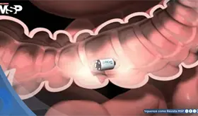 Crean p&iacute;ldoras inteligentes con bacterias para detectar enfermedades intestinales sin colonoscopia