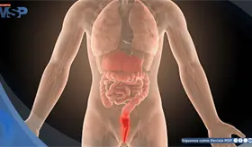 Dolor rectal, sangrado y urgencia para evacuar: s&iacute;ntomas que alertan sobre una proctitis 