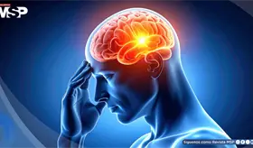 &iquest;Migra&ntilde;a, dolor de cabeza o cefalea? As&iacute; puede diferenciarlas y reconocer sus s&iacute;ntomas