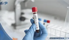 Crean prueba que diferencia infecci&oacute;n real de VIH de falsos positivos causados por vacunas experimentales