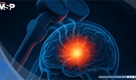 Estimulaci&oacute;n magn&eacute;tica transcraneal frenar&iacute;a el deterioro cognitivo y la demencia en 76% de los pacientes