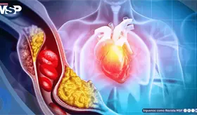 Revertir la prediabetes reduce a la mitad el riesgo de muerte cardiovascular, seg&uacute;n estudio