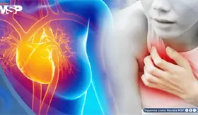 M&aacute;s de la mitad de los infartos en mujeres j&oacute;venes no se deben a obstrucci&oacute;n arterial