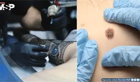 Tatuajes y piercings dificultar&iacute;an detecci&oacute;n temprana de lesiones malignas en la piel, advierten m&eacute;dicos