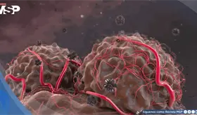 Casi el 40 % de los nuevos c&aacute;nceres diagnosticados en el mundo podr&iacute;an ser prevenibles