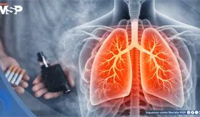 Efectos en la salud del vapeo y el tabaquismo &iquest;Cu&aacute;les son las similitudes y diferencias  cl&iacute;nicas?
