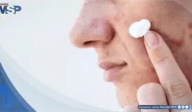 Skincare viral en redes podr&iacute;a causar quemaduras, manchas y hasta lesiones precancer&iacute;genas