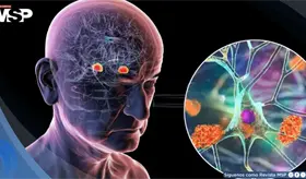 Un an&aacute;lisis de sangre podr&iacute;a predecir el alzh&eacute;imer hasta 20 a&ntilde;os antes de que aparezcan los s&iacute;ntomas