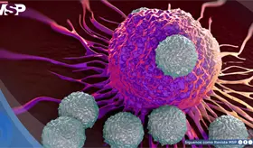 Logran reprogramar c&eacute;lulas del sistema inmune contra el c&aacute;ncer directamente dentro del cuerpo