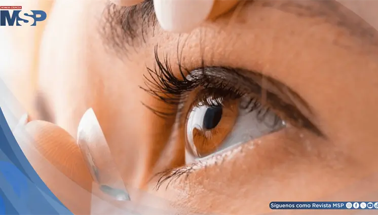 Lente de contacto con IA detecta picos de presión ocular y libera fármaco contra el glaucoma Lente de contacto con IA detecta picos de presión ocular y libera fármaco contra el glaucoma