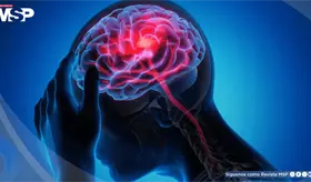 Identifican prote&iacute;na que podr&iacute;a frenar las malformaciones cavernosas cerebrales sin efectos adversos 