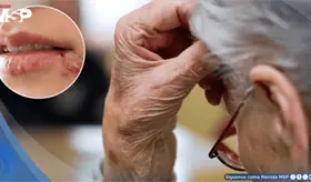 Estudio revela que el virus del herpes podr&iacute;a contribuir al desarrollo de la enfermedad de Alzheimer