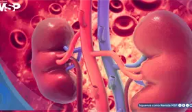Ensayos con SGLT2, finerenona y agonistas GLP-1 impulsan avances de enfermedad renal en diabetes tipo 1