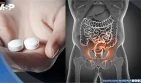 Descubren que la aspirina podr&iacute;a reducir hasta en un 50 % el riesgo de c&aacute;ncer colorrectal y recurrencia