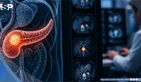 Desarrollan una IA que detect&oacute; c&aacute;ncer de p&aacute;ncreas 475 d&iacute;as antes que el diagn&oacute;stico cl&iacute;nico