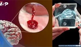 Desarrollan el primer aerosol nasal con nanopart&iacute;culas para tratar el ictus antes de llegar al hospital