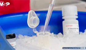 Qu&eacute; es la RT-PCR con la que se diagnostica el hantavirus, y qu&eacute; otras pruebas existen para detectarlo