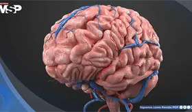 Parche de seda implantado en el cerebro muestra potencial para reparar da&ntilde;os tras un ictus