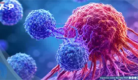 De combatir el c&aacute;ncer a tratar lupus y esclerosis m&uacute;ltiple: as&iacute; funciona la terapia CAR T
