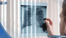 Crean tratamiento oral supera a la quimioterapia en un dif&iacute;cil subtipo de c&aacute;ncer de pulm&oacute;n