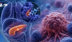 Nuevo f&aacute;rmaco duplica la supervivencia en c&aacute;ncer de p&aacute;ncreas metast&aacute;sico