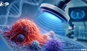 Terapia de pulsos frena el crecimiento tumoral en investigaci&oacute;n precl&iacute;nica sobre c&aacute;ncer colorrectal