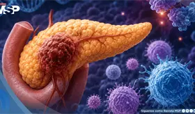 Estudio propone estrategia contra el c&aacute;ncer de p&aacute;ncreas: bloquea prote&iacute;na clave y activa sistema inmune
