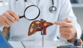 Hepatitis Delta enciende alertas por su v&iacute;nculo con c&aacute;ncer hep&aacute;tico y riesgo de evoluci&oacute;n acelerada