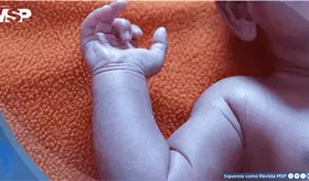 Beb&eacute; de 20 d&iacute;as diagnosticado con una cardiopat&iacute;a cong&eacute;nita que causa cianosis