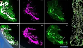 Nueva tecnolog&iacute;a de im&aacute;genes con IA detecta neuropat&iacute;a asociada a la obesidad