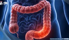 C&aacute;ncer colorrectal en menores de 50 a&ntilde;os: aumenta el tamizaje, pero persisten las desigualdades