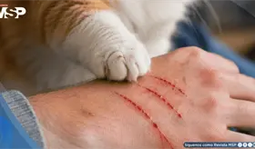 Infecciones por rasgu&ntilde;os de gato y micobacterias pueden confundirse con c&aacute;ncer y retrasar el diagn&oacute;stico