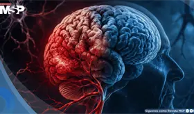 No todo deterioro cognitivo es alzh&eacute;imer: la demencia vascular es la segunda causa m&aacute;s frecuente
