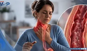 Esofagitis eosinof&iacute;lica: qu&eacute; s&iacute;ntomas alertan, c&oacute;mo se diagnostica y cu&aacute;les son sus tratamientos