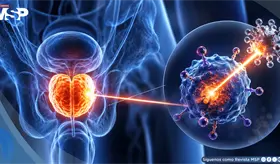 C&aacute;ncer de pr&oacute;stata: un radiof&aacute;rmaco reduce 28% el riesgo de progresi&oacute;n